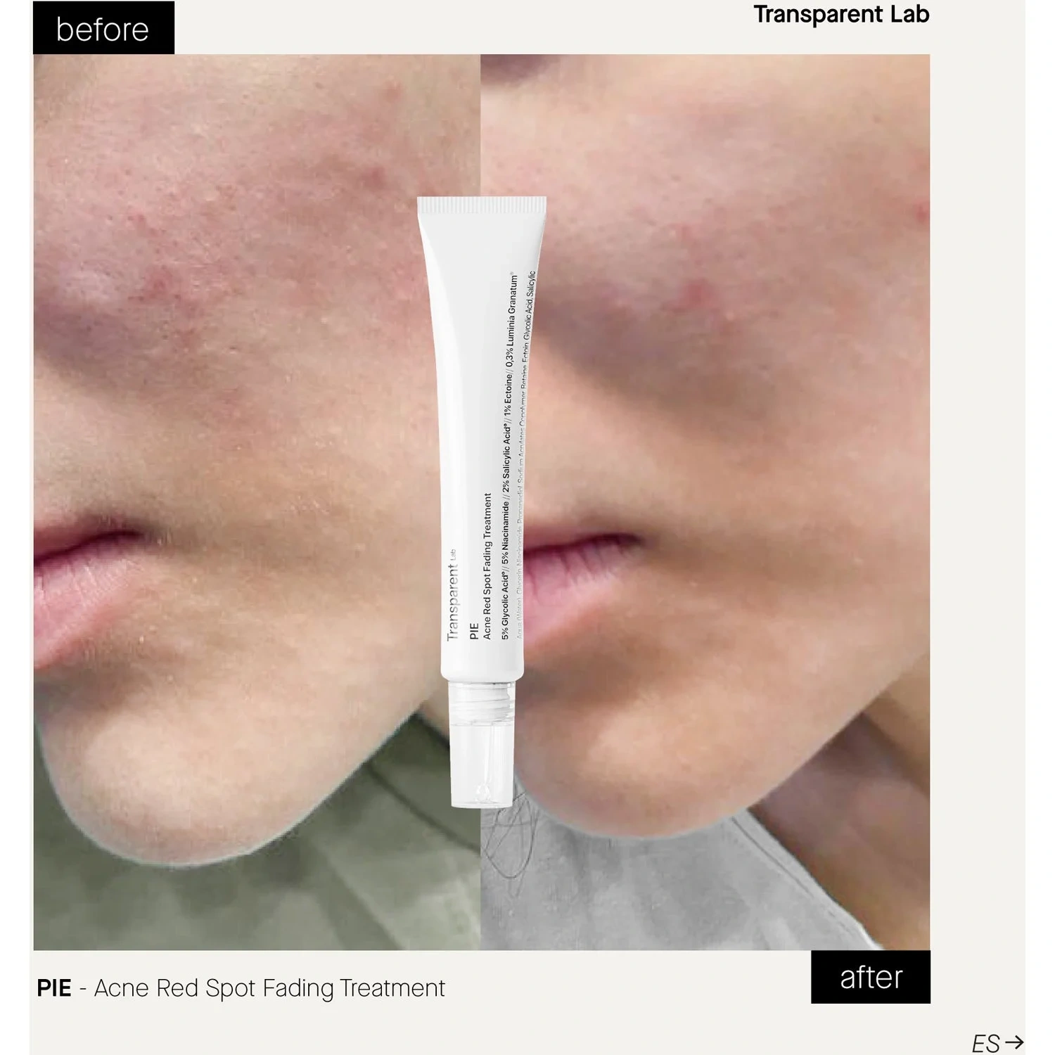 Niche Beauty Lab Transparent Lab