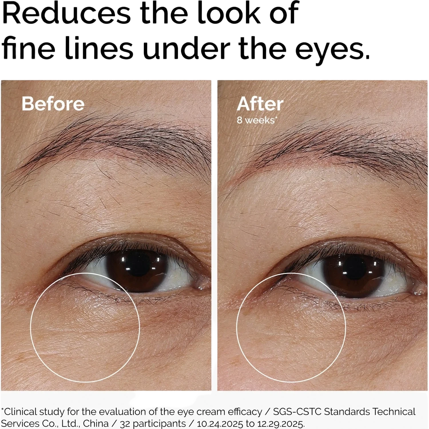 The Ordinary Lacto-PDRN* 4% +B9 Eye Cream