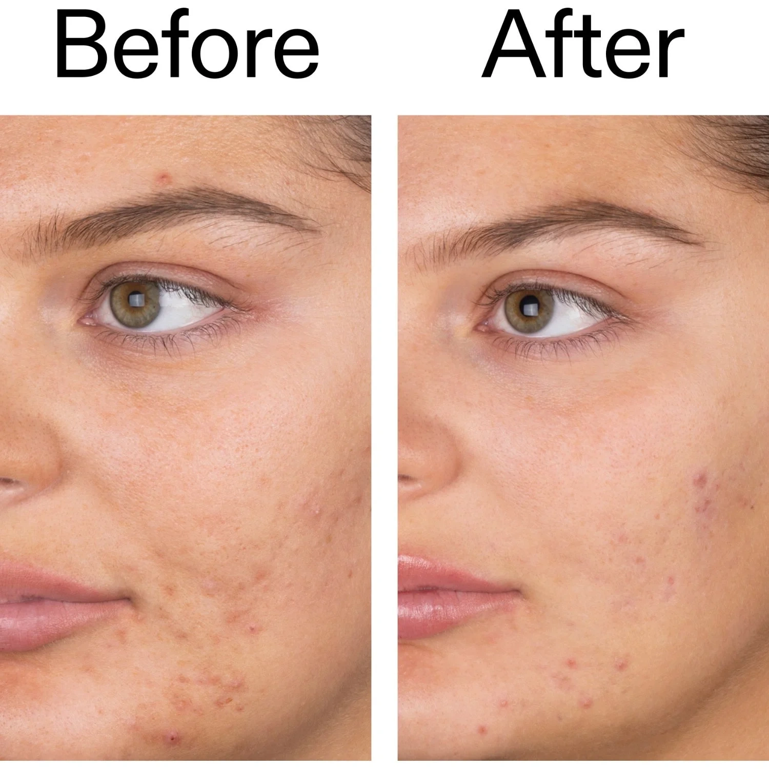 The Inkey List Salicylic Acid Cleanser 150 ml