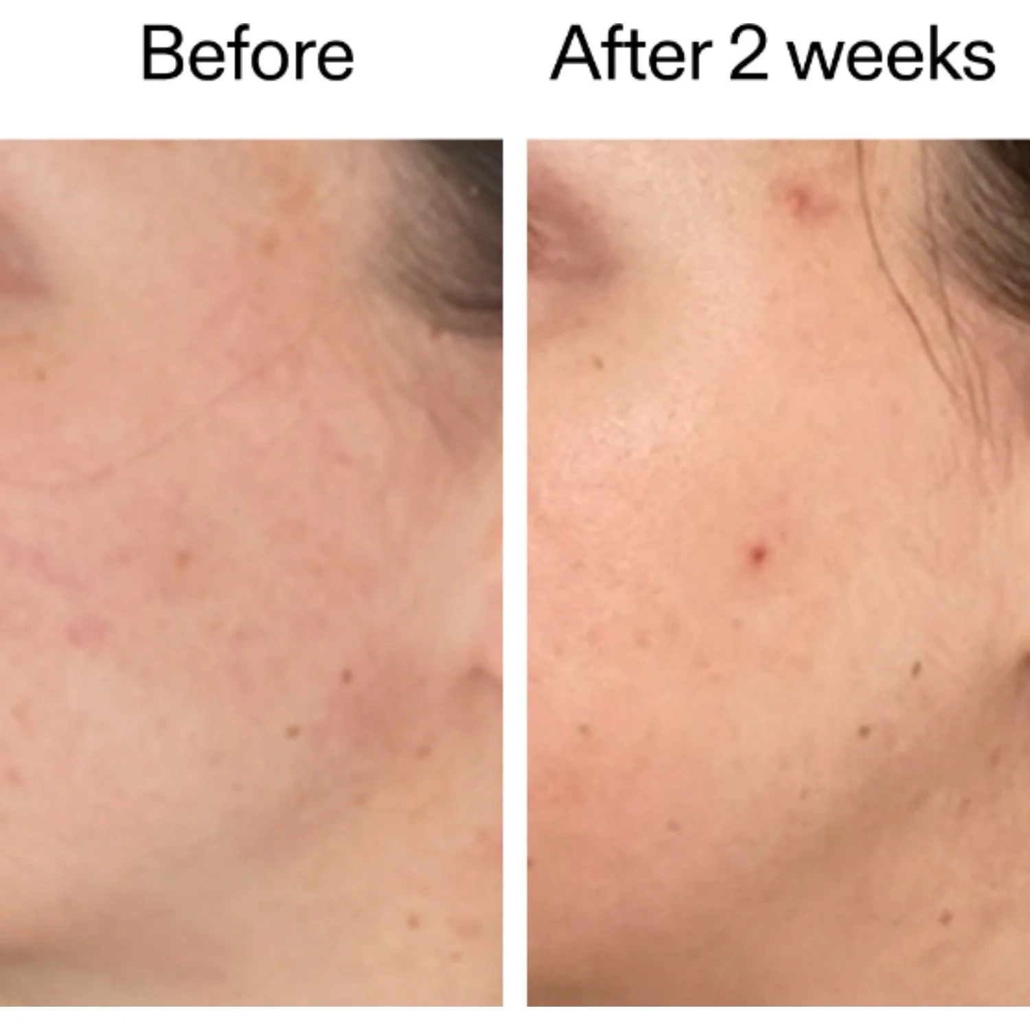The INKEY List 360° Skin Clearing Serum 30 ml