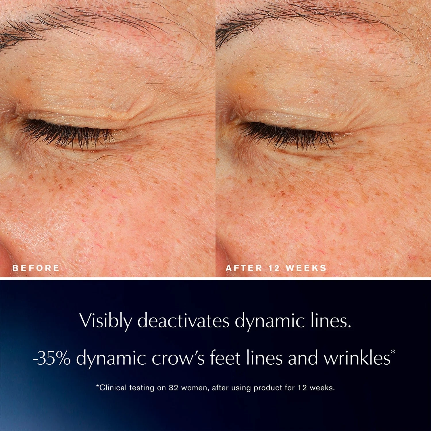 Estée Lauder Advanced Night Repair Eye Concentrate Serum